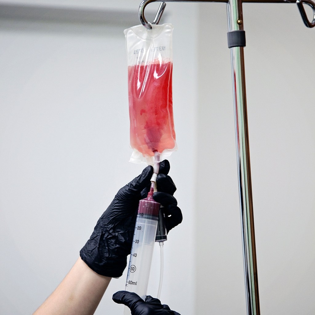 Patient receiving ozone therapy in a wellness clinic