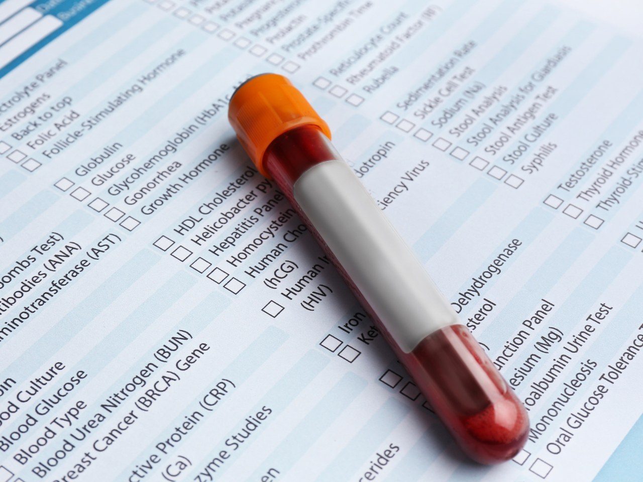 Lab test vial resting on a diagnostic requisition form